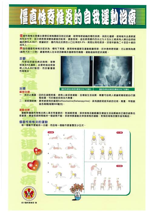 僵直性脊椎炎的自我運動治療